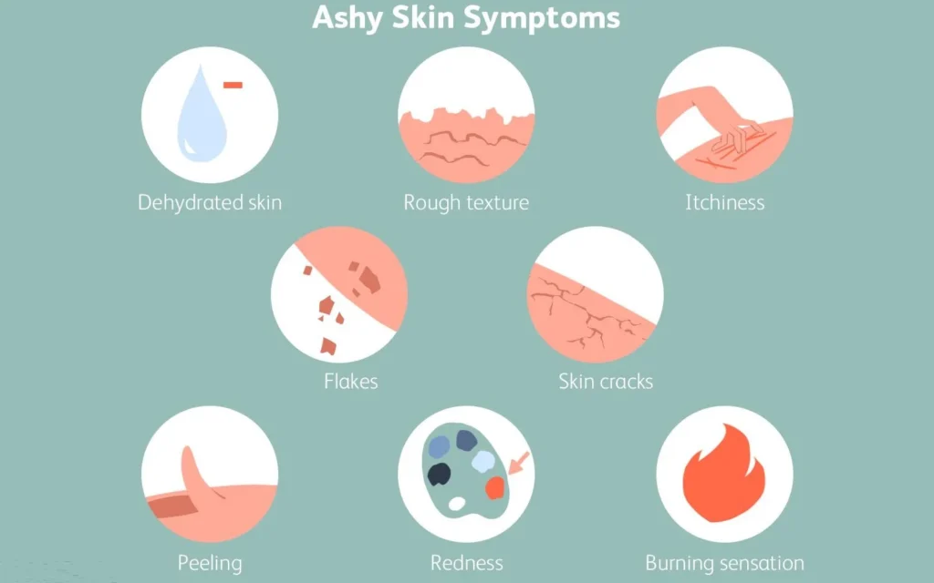 Ashen Skin Symptoms