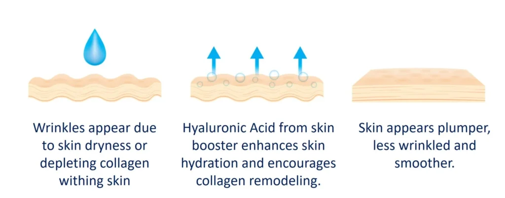 What are skin boosters, and how do they work?