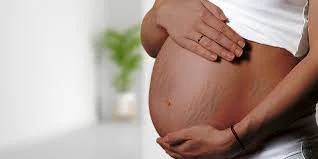 How Pregnancy Can Affect Your Skin