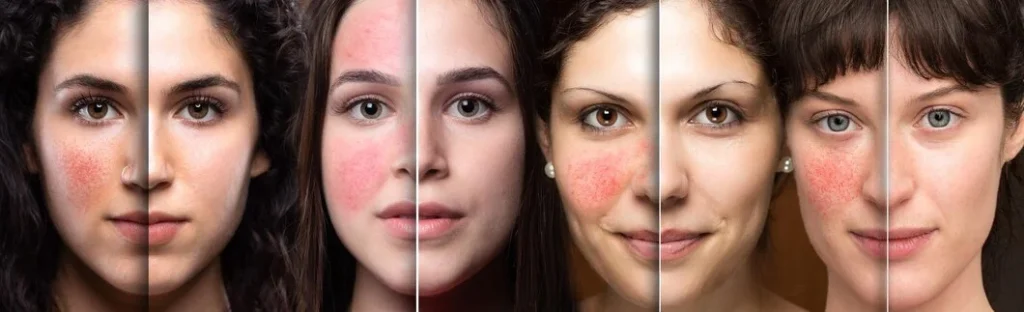 causes of enough using retinol