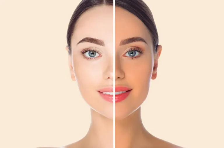 Fairy Skin Tone