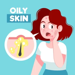 Oily skin, also known as seborrhea